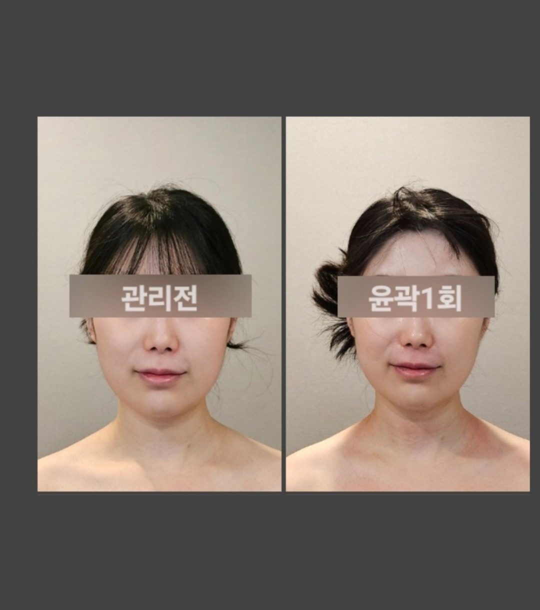 윤곽관리로 동안얼굴 만들기