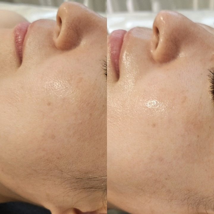 피부고민해결사! 솔루션앰플 레이어링하여 최대의 효과를 보여드려요🔥