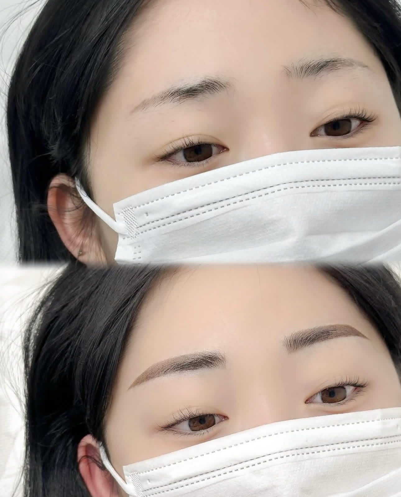 “성형보다 효과좋아요” , 3월 10% 할인 🫶🏻