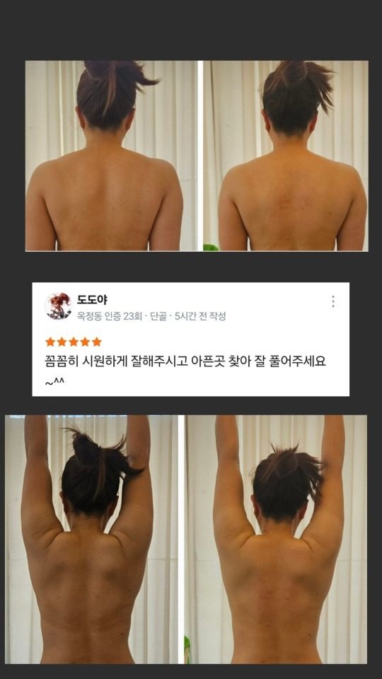 두통과 근막 통증에 효과적인 브레인 테라필링!