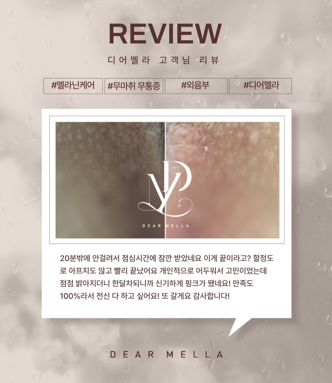 하이샾뷰티 picture 7