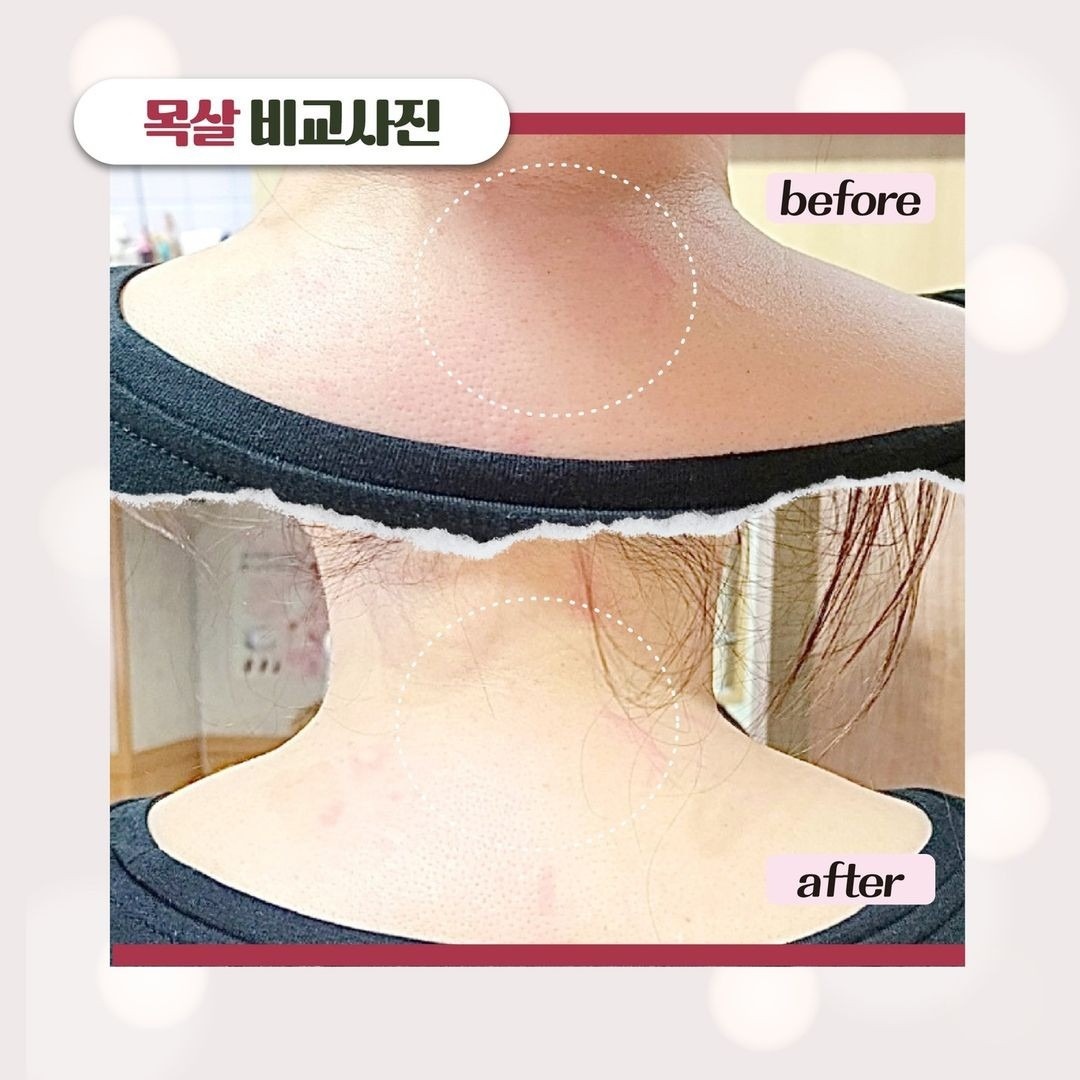 김옥숙 피부체형관리실 picture 7