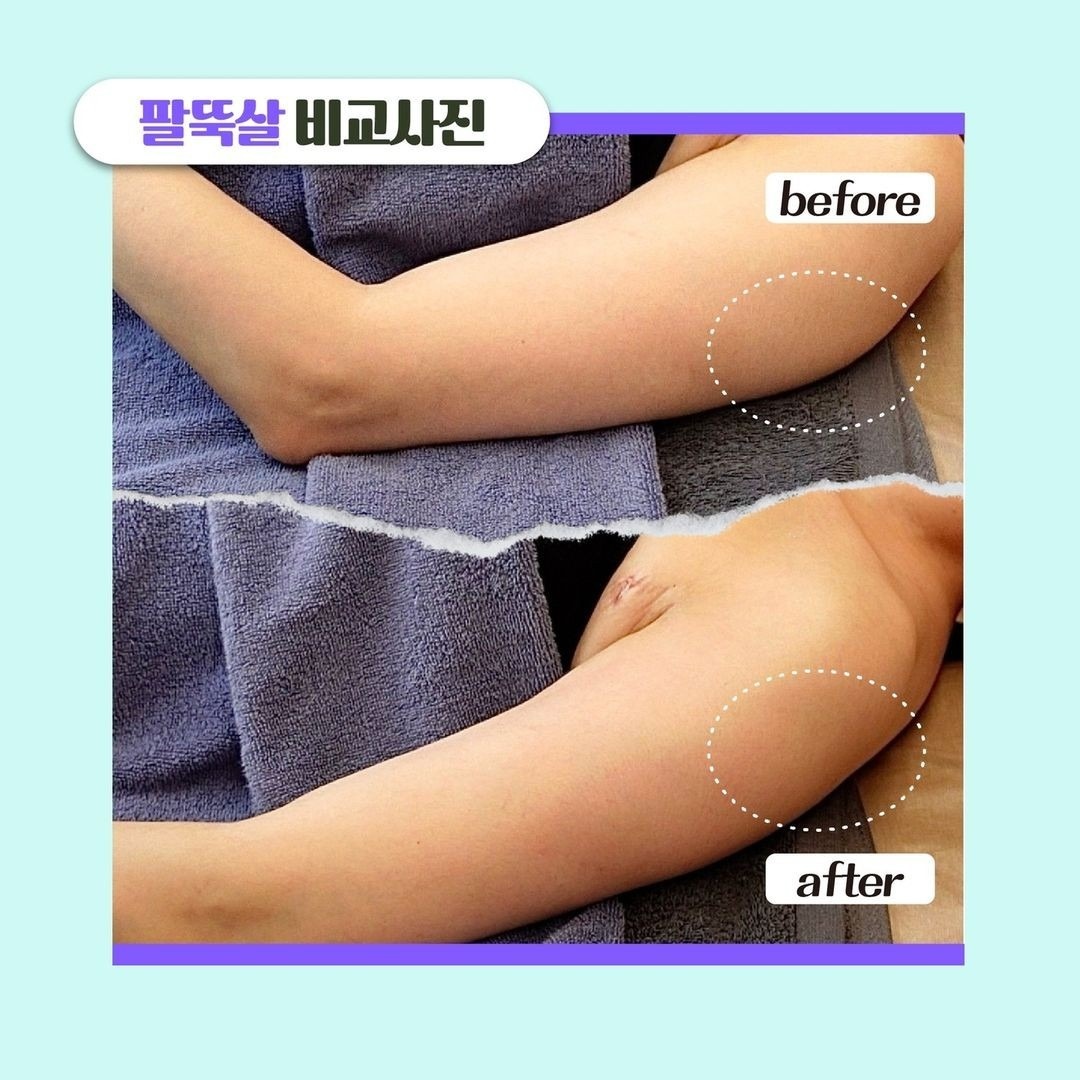 김옥숙 피부체형관리실 picture 9