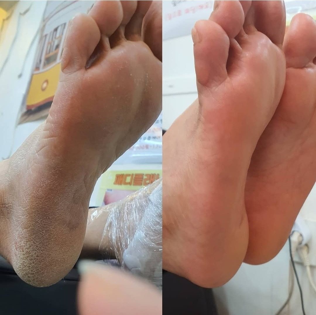 아기발만들기~~(패디플래닝) 55000원