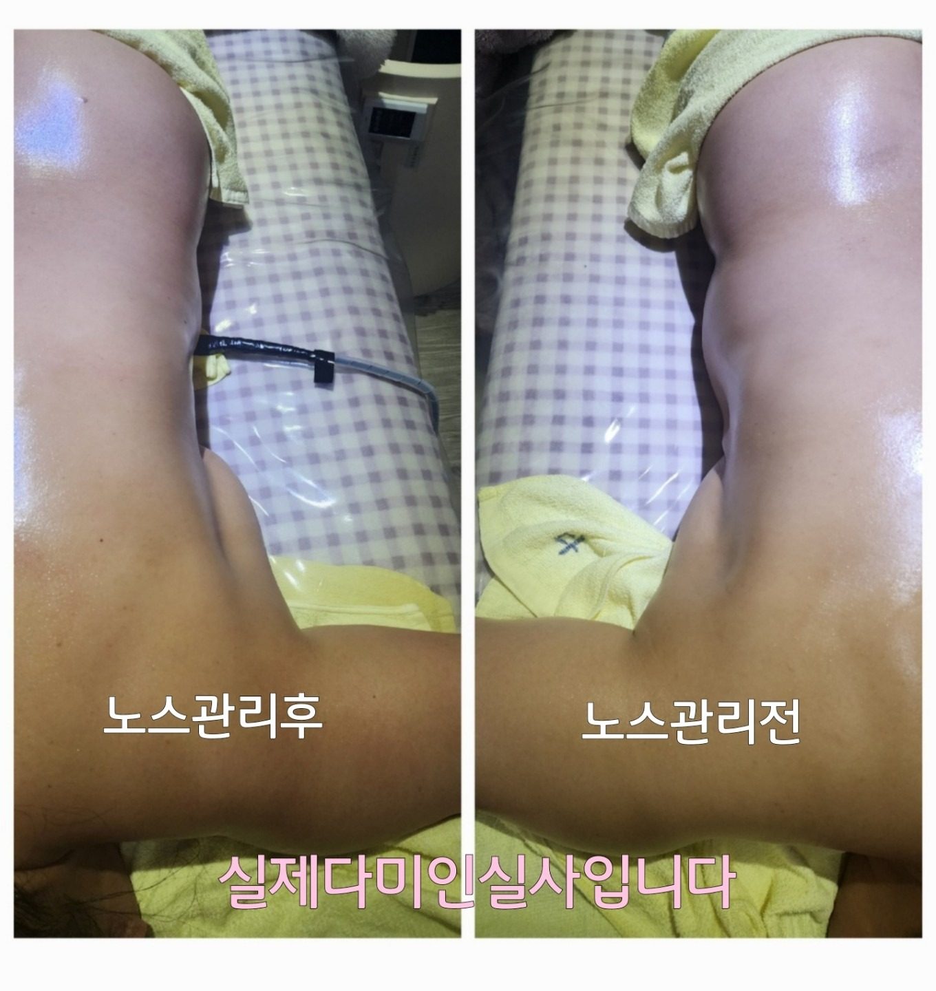 등ㆍ어깨ㆍ뒷목ㆍ팔ㆍ허리통증 더는참지마세요 