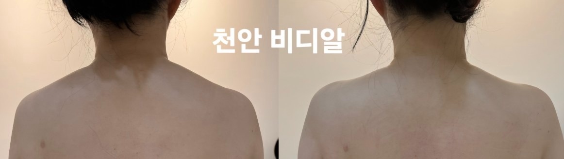 bdr 비디알 picture 7