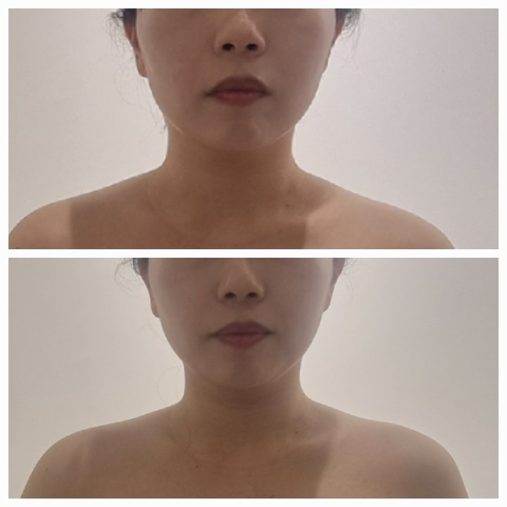 bdr 비디알 picture 1