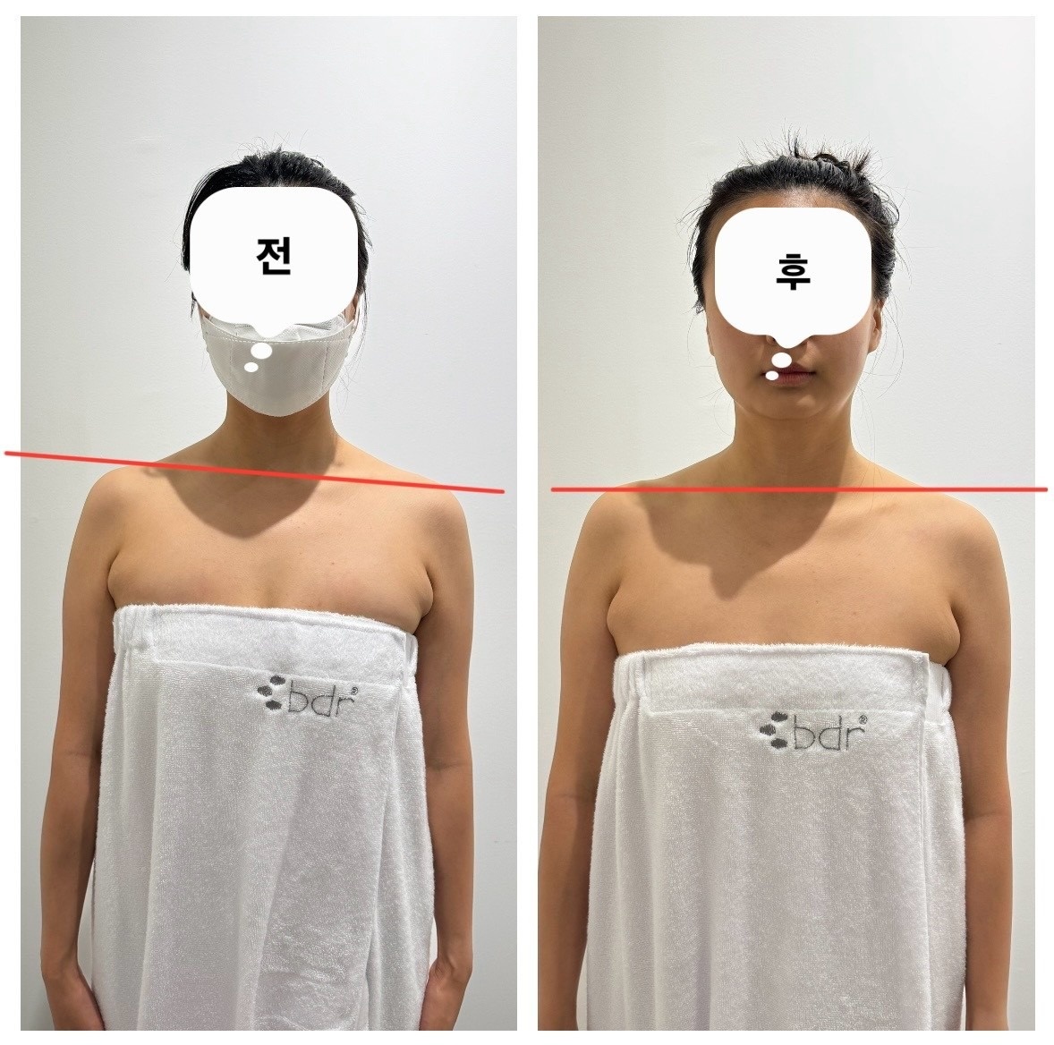 bdr 비디알 picture 2