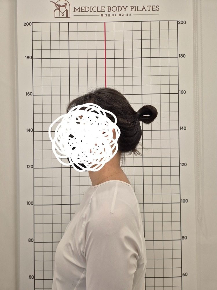 거북목 방치하면 돌이킬수 없습니다! 당일등록특별할인🎁