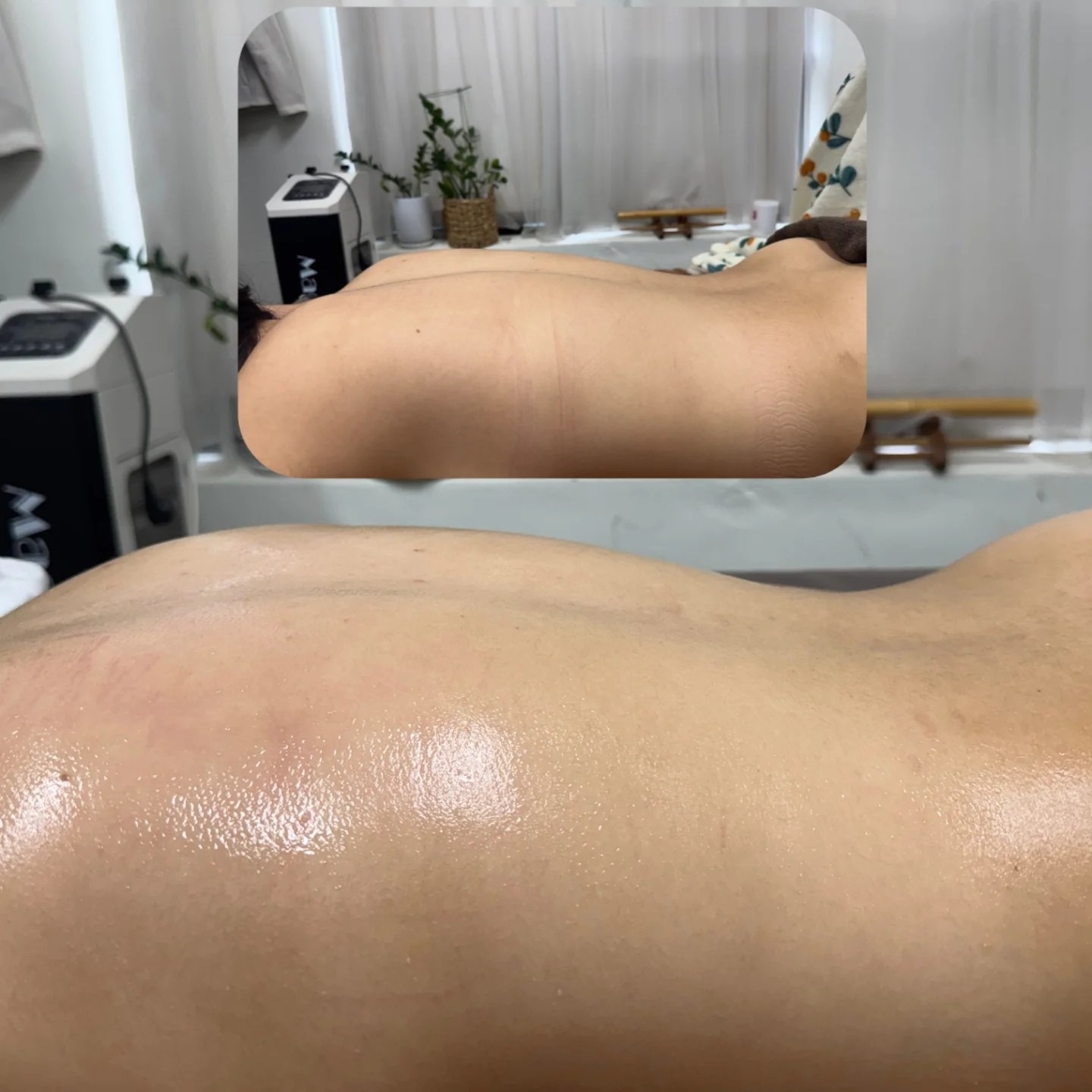 피부해온 picture 1