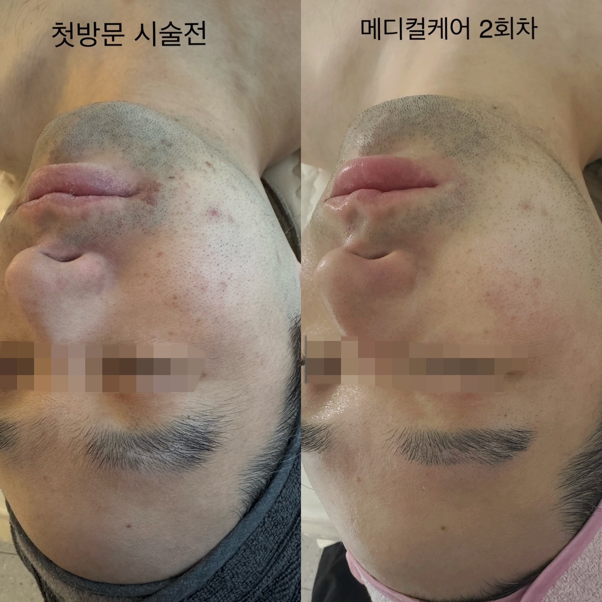 최강뷰티 picture 3