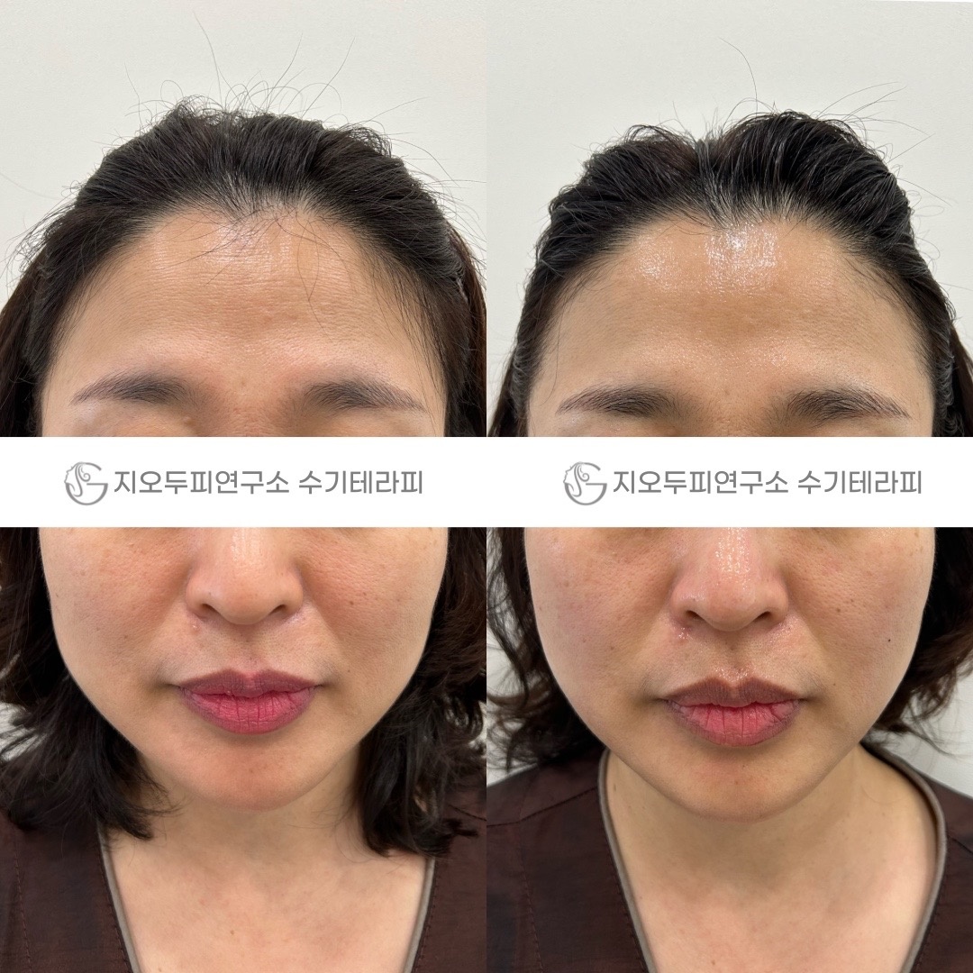 지오두피연구소 picture 6