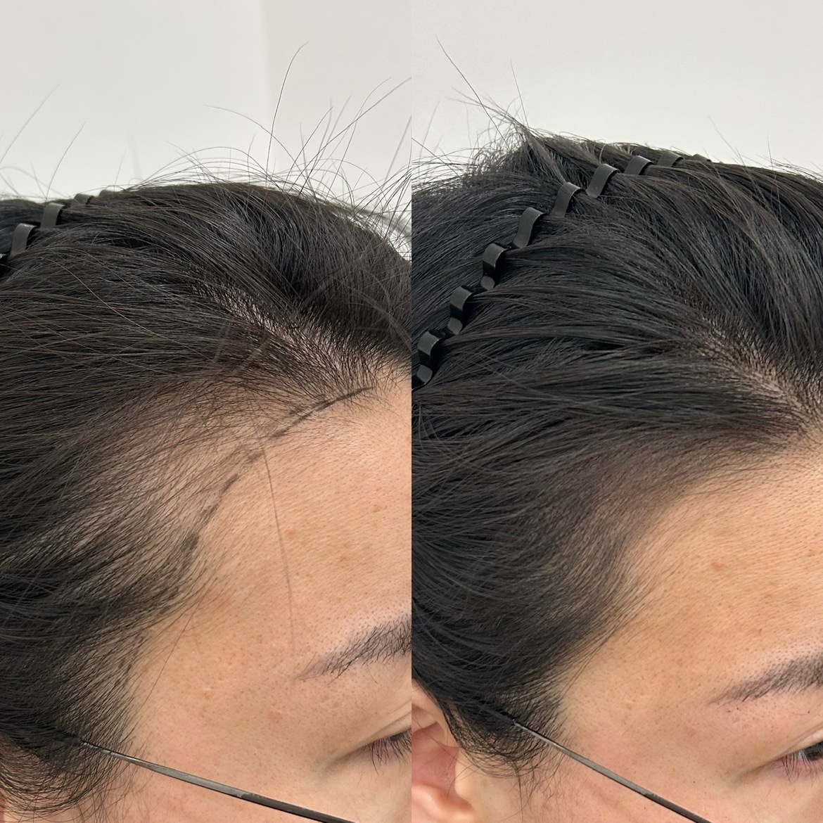 지오두피연구소 picture 8