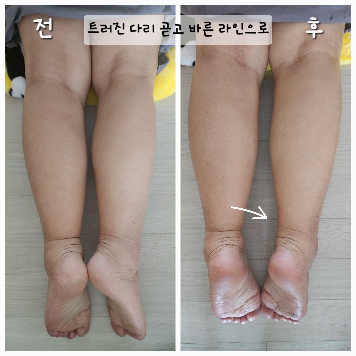 "살이 안빠지는 이유? 순환이 막혔을지도 몰라요"