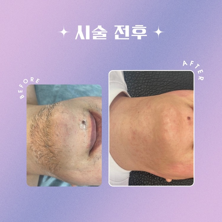 진슈가링왁싱 picture 1