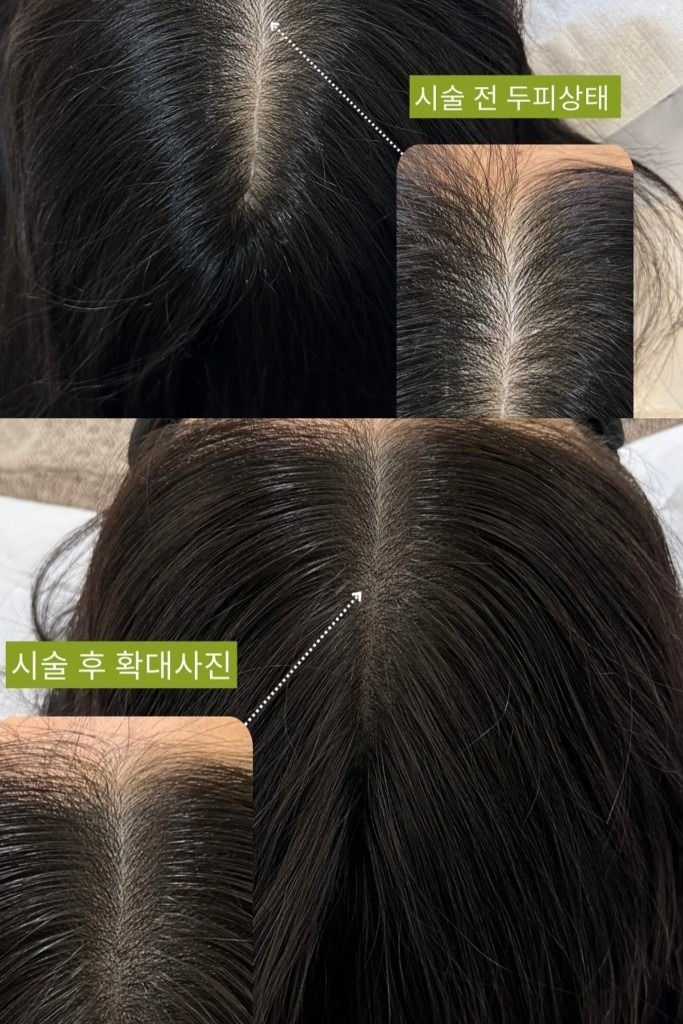 희소뷰티 picture 1