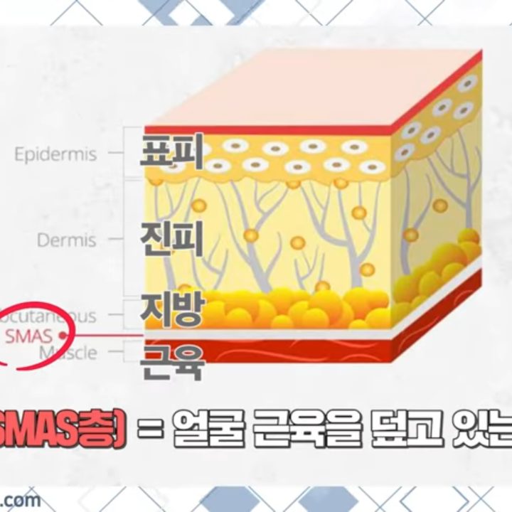 다이아