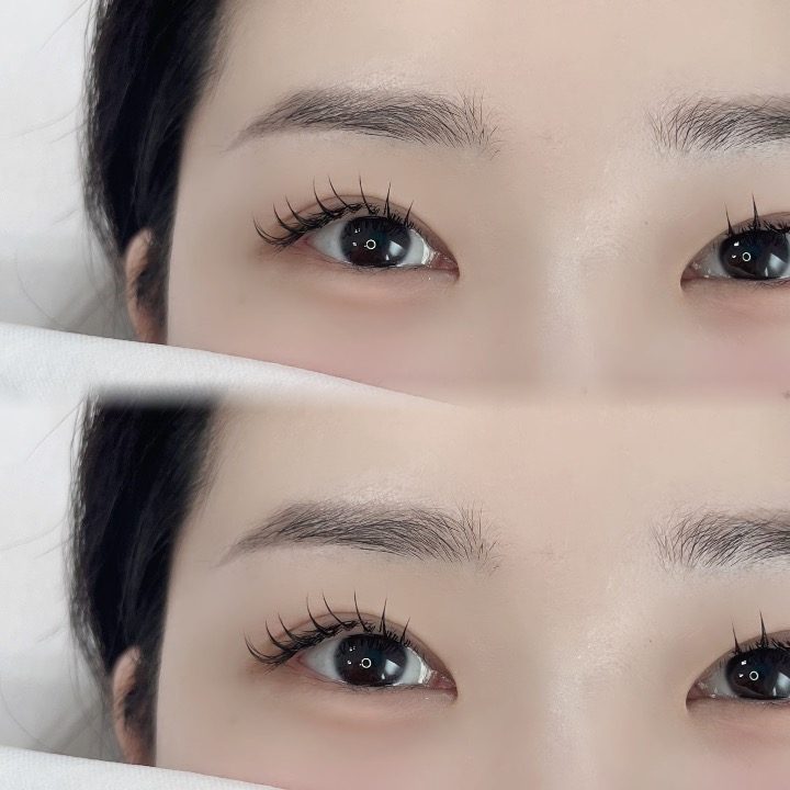 바나나쮸