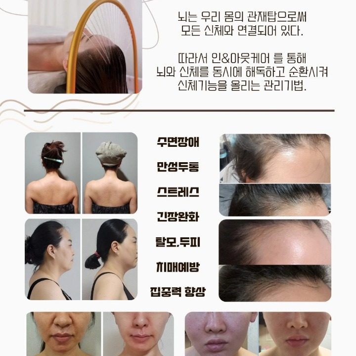 두피케어