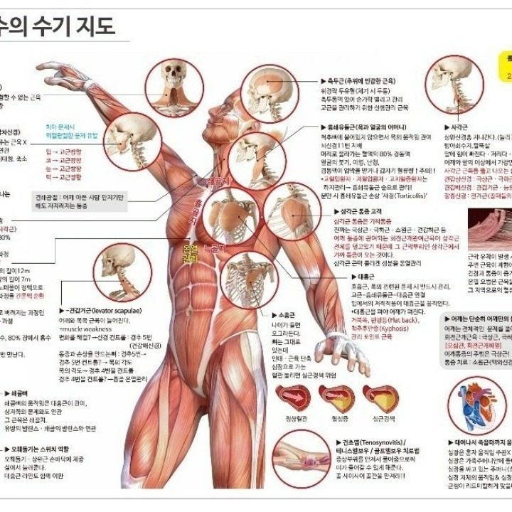 테라피 휴