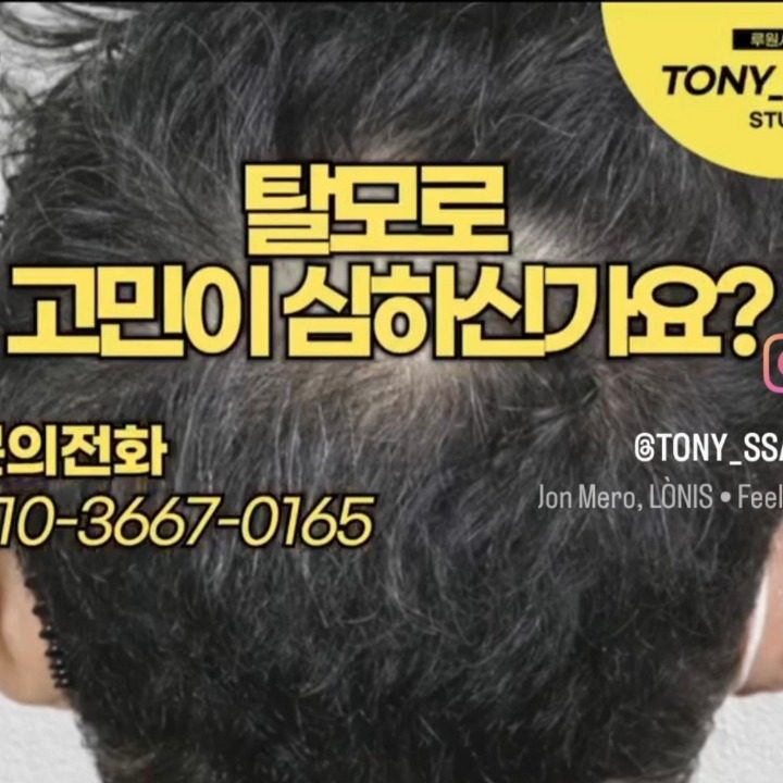 토니 스칼프