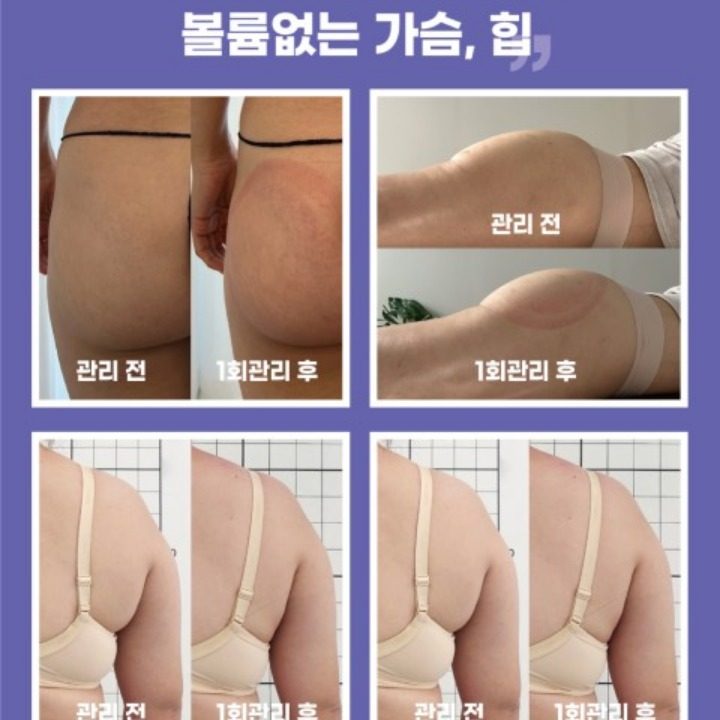 다이어트.피부.체형관리.반영구.속눈썹펌.두피문신