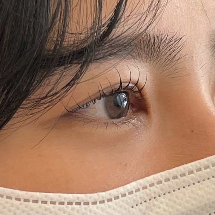 허즈
