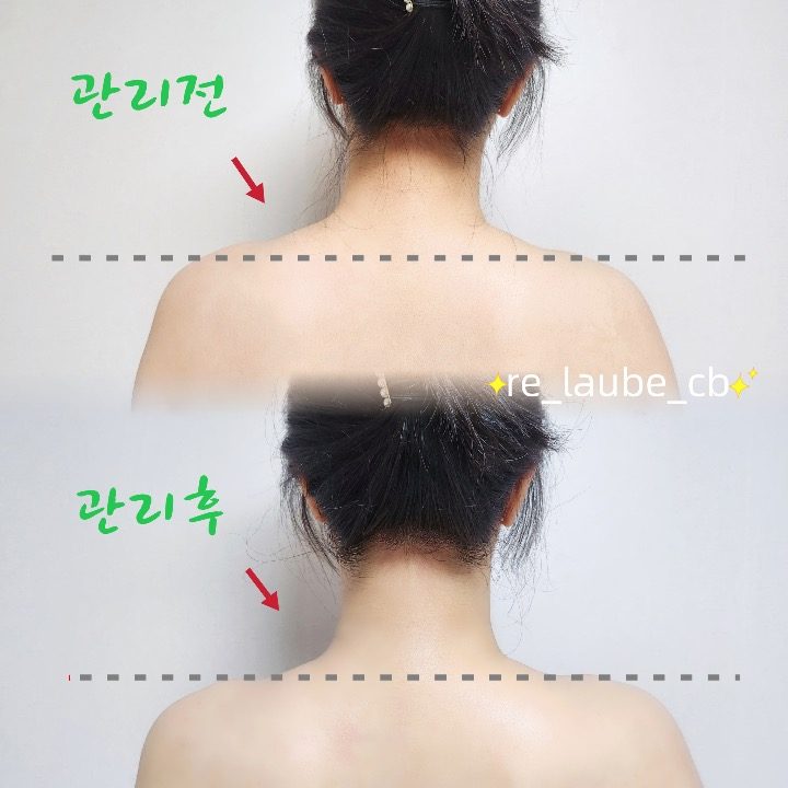 리로브스킨앤바디