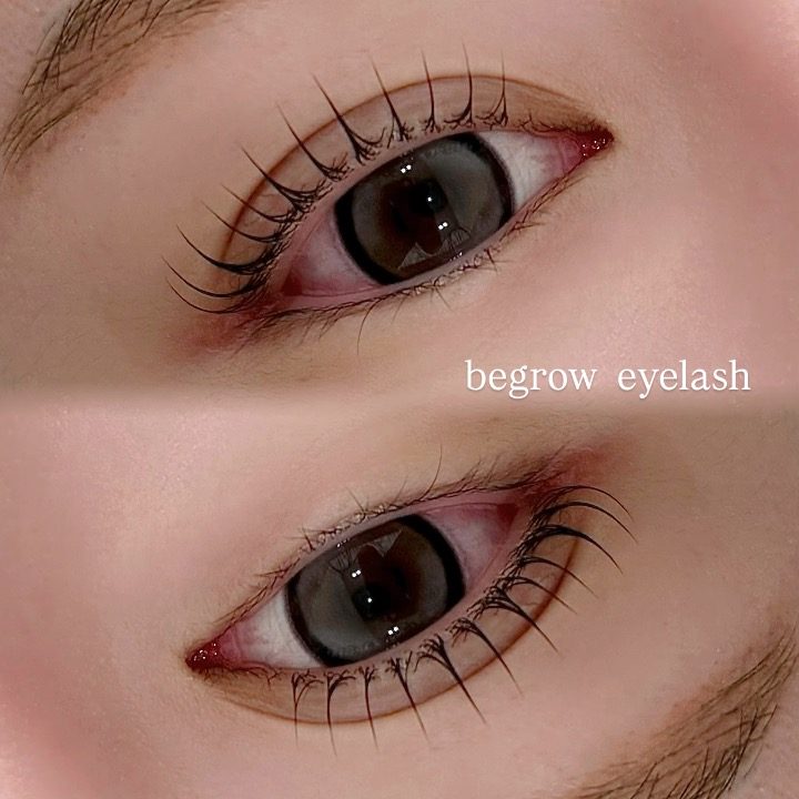 비그로우(Be grow)