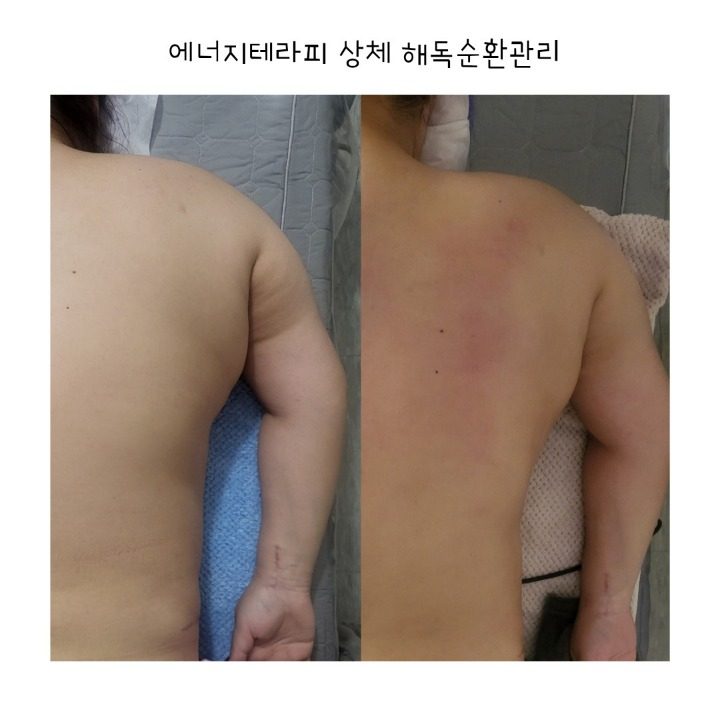 피부관리마사지