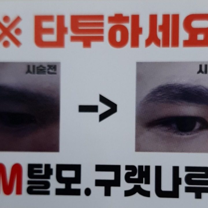 맨즈 토탈