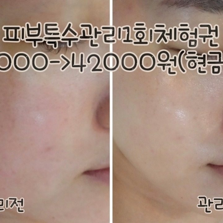 두피피부탈모관리센터