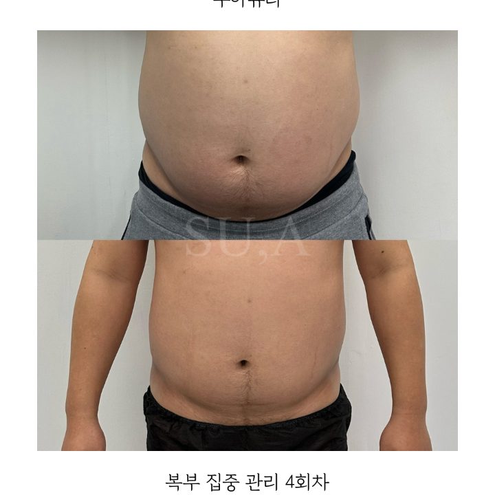 수아뷰티