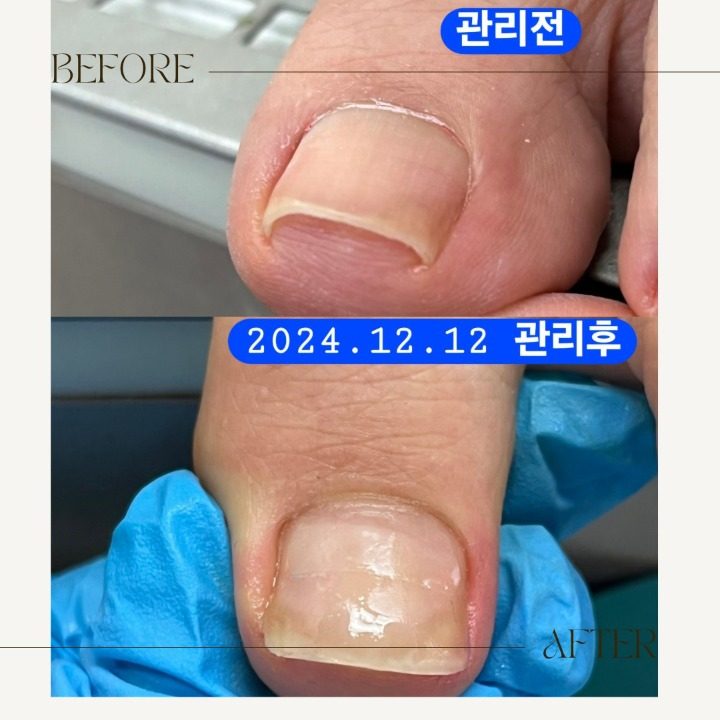 메디컬풋케어