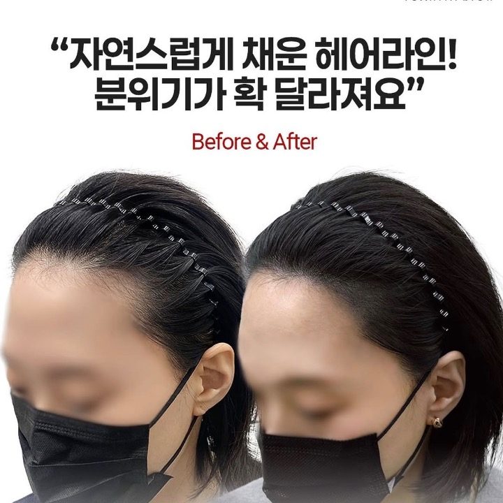 강남 두피 관리샵