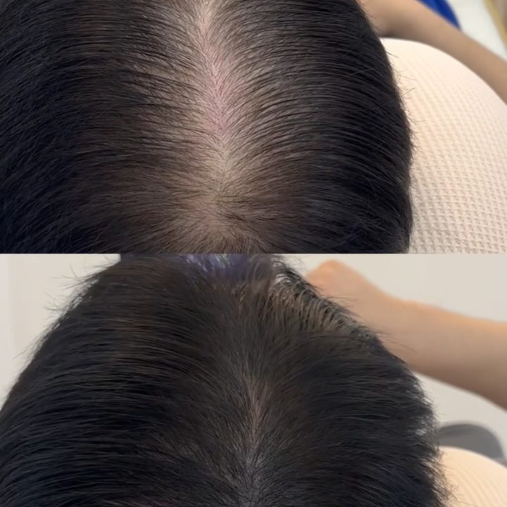 수풀림 두피관리