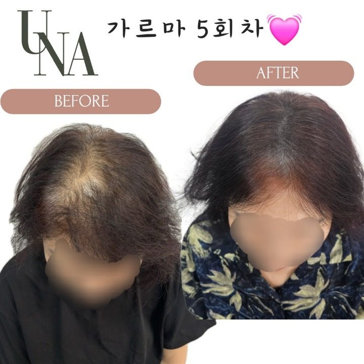 유나도트