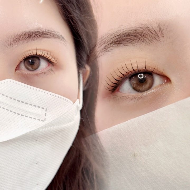 박하래쉬