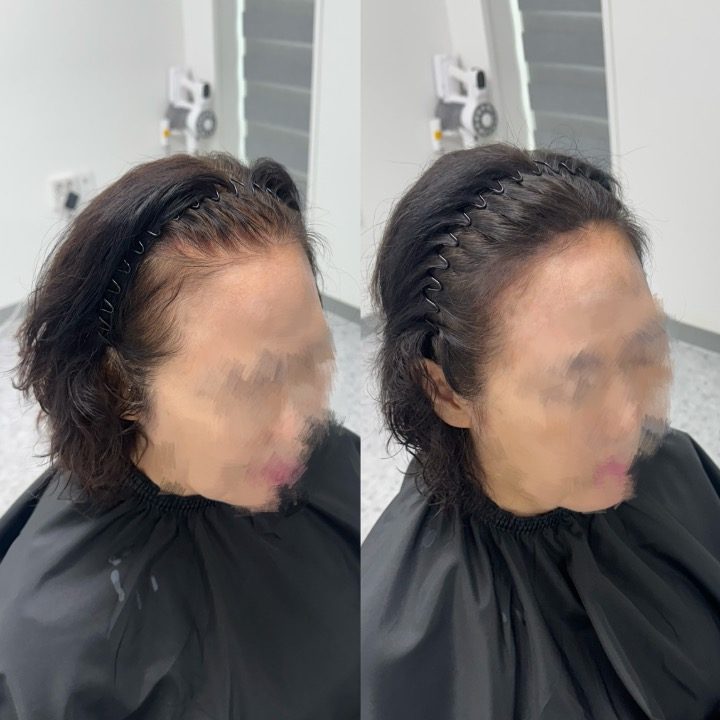 플럼미뷰티앤스칼프