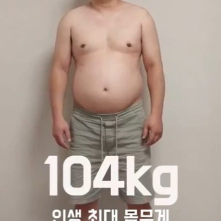 에소코핏 용인수지점