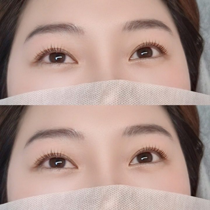 리엔아이즈
