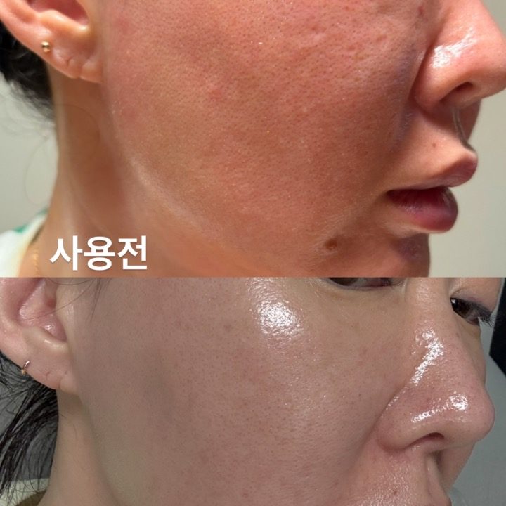K뷰티 인셀덤