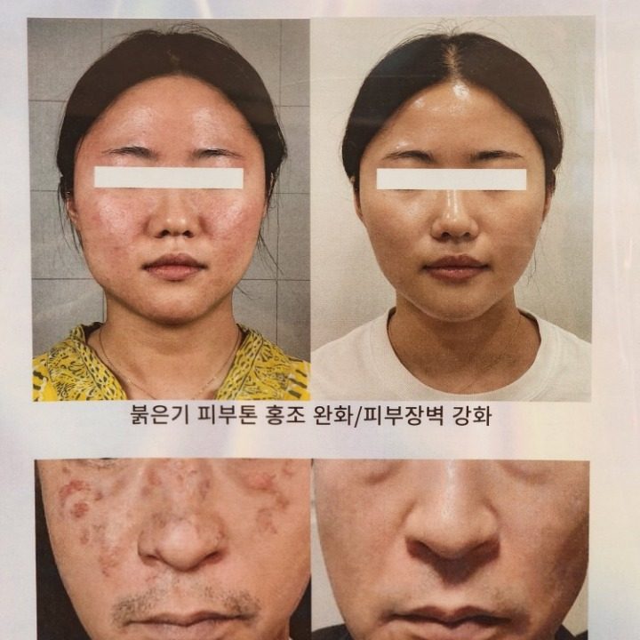 V라인피부관리실