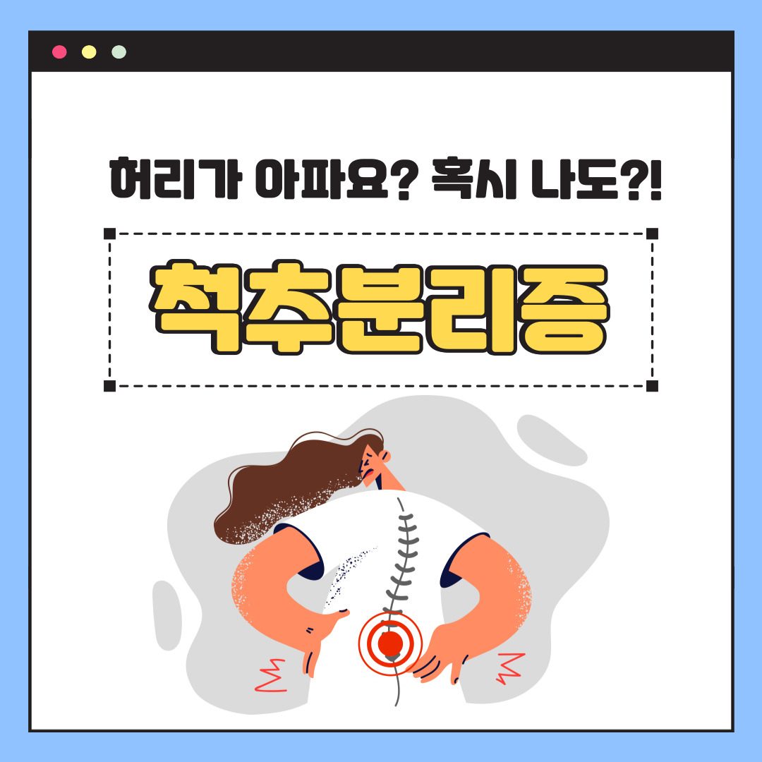 허리가 아프다면? 혹시 나도?! 척추분리증 ✍️ 원당시장 신경외과에서 진료받아보세요!