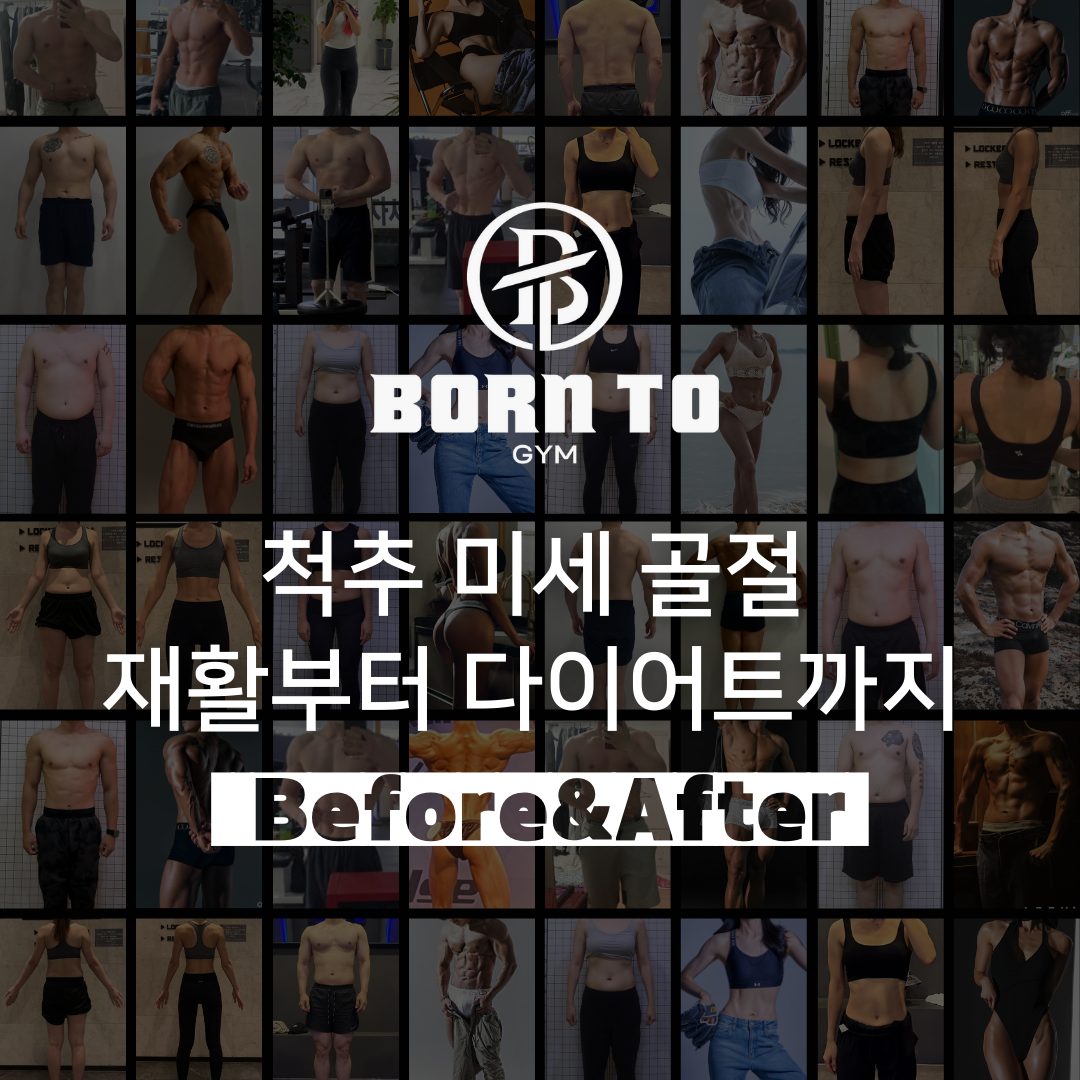 척추 미세 골절 재활 Before & After 