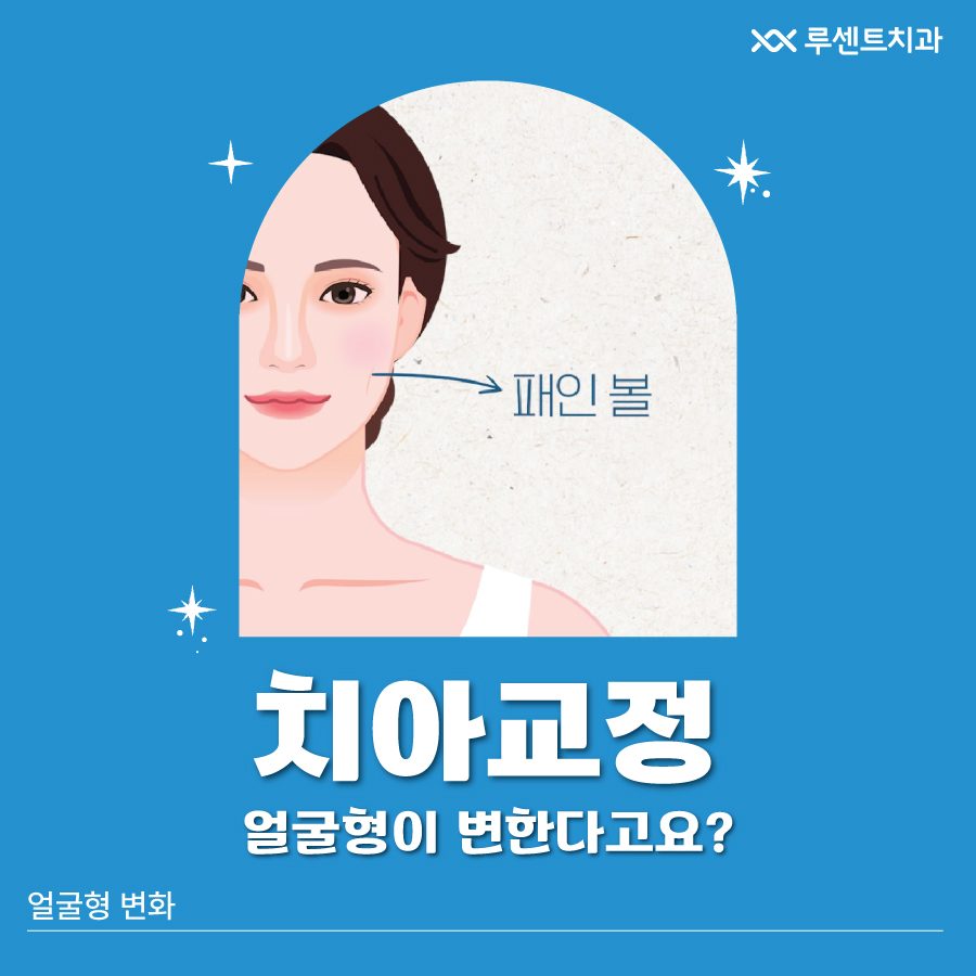 치아교정하면 얼굴형이 변할 수도 있다고요?😮