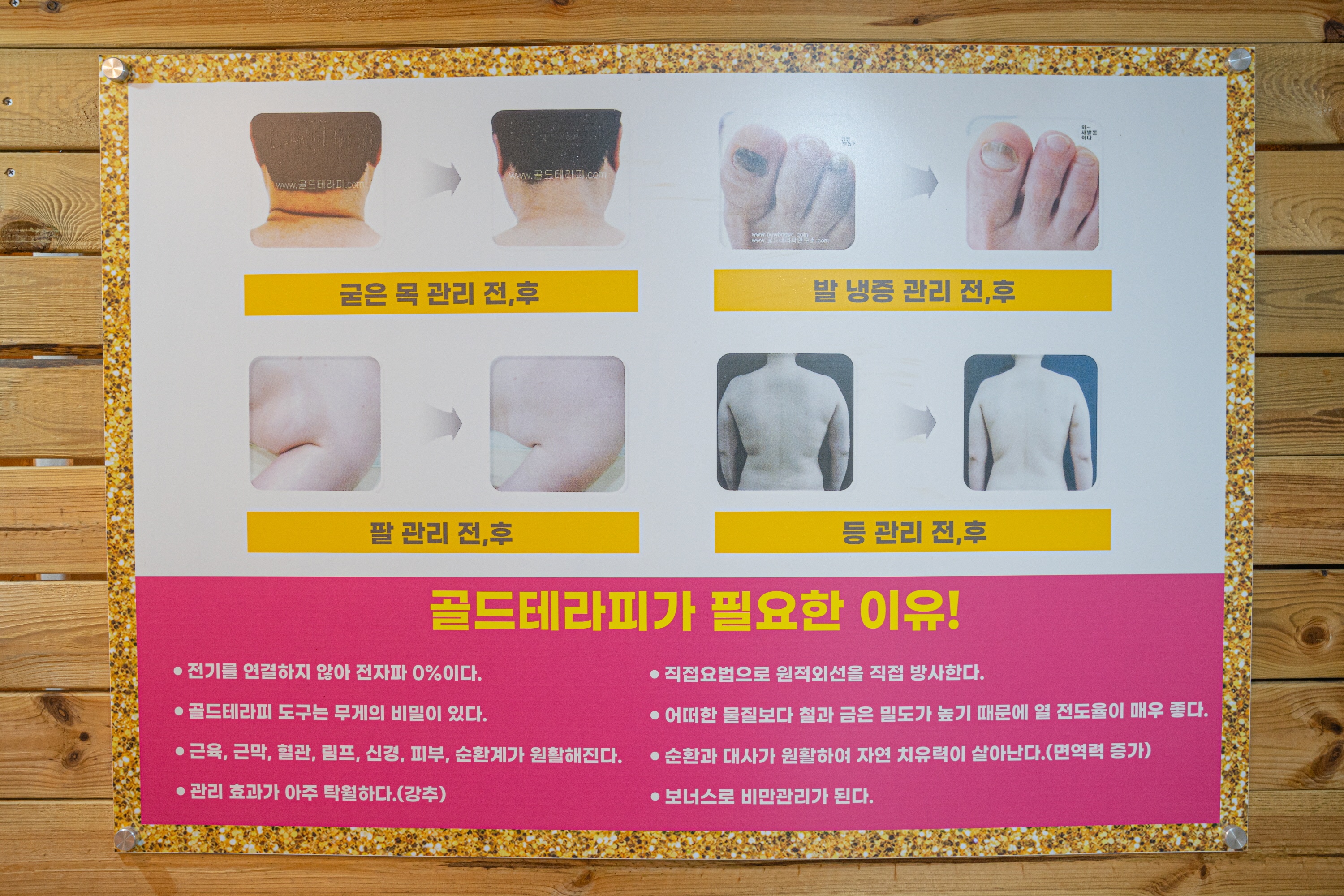 하미숙 골드테라피 picture 5