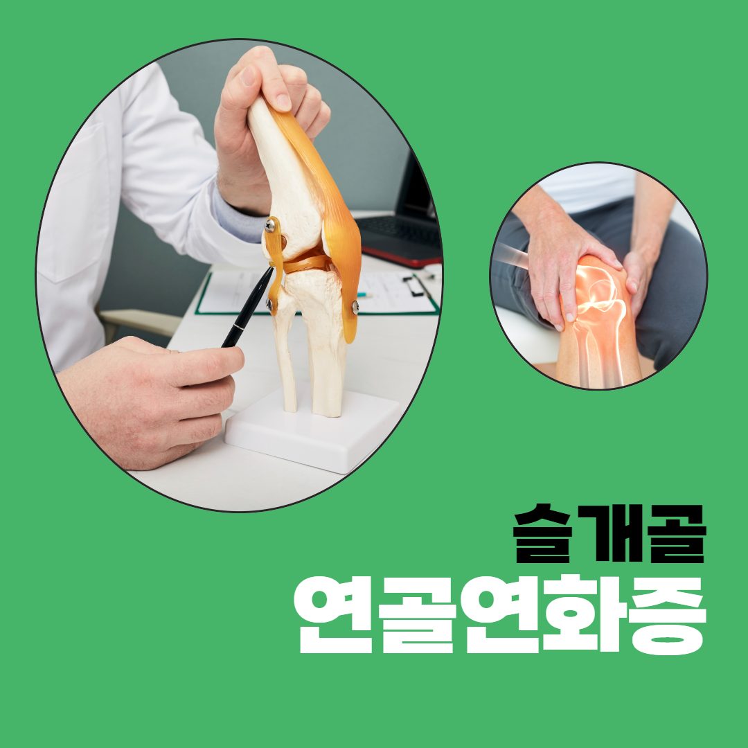 무릎이 뻐근해지는 연골연화증😨