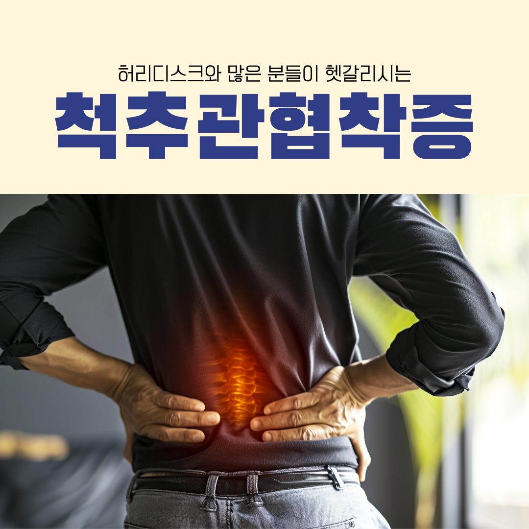허리가 아파오는 척추관협착증🏥용암동 정형외과🏥에서 알아봅시다!