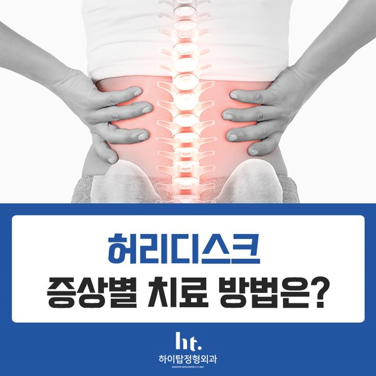 [태전동정형외과] 허리디스크의 증상별 치료 방법